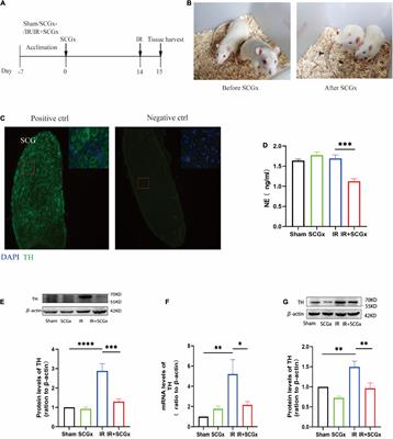 The Role of the Superior Cervical Sympathetic Ganglion in Ischemia Reperfusion-Induced Acute Kidney Injury in Rats